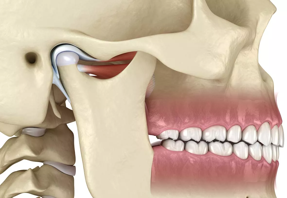 tmj treatment